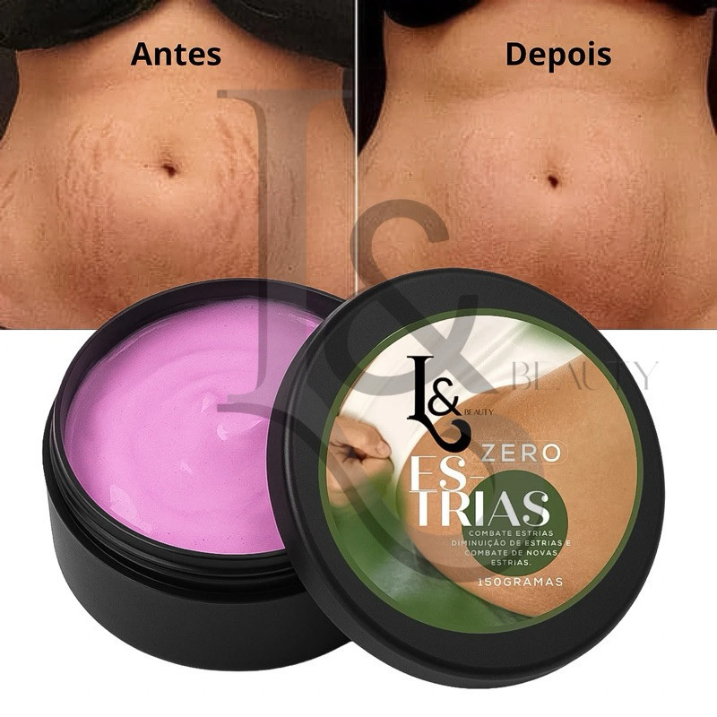 Creme Anti Estrias Trata E Previne 150g - L&Beauty